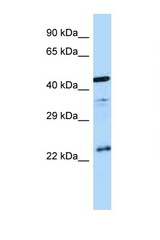 AVPR1B antibody LS-C146050 Western blot of Fetal Brain lysate. Antibody concentration 1 ug/ml.