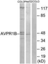 Western blot of extracts from COLO/HepG2 cells, using AVPR1B Antibody. The lane on the right is treated with the synthesized peptide.
