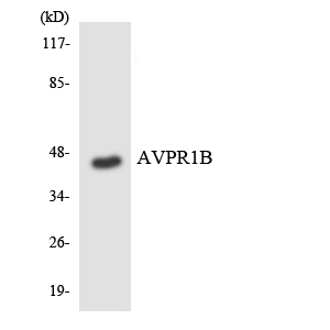 Western blot of the lysates from HUVEC cells using AVPR1B antibody.