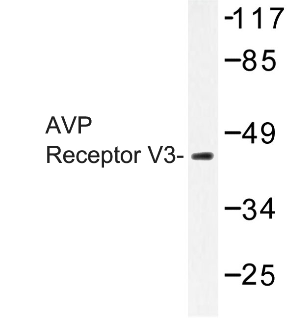 Western blot of AVP Receptor V3 (D314) pAb in extracts from COLO/HepG2 cells.