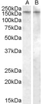 LS-B2769 (0.5 ug/ml) staining of Human Amygdala lysate (35 ug protein in RIPA buffer) in lane A and LS-B5241 (0.05 ug/ml) staining of Rat Brain lysate (35 ug protein in RIPA buffer) in lane B. Primary incubation was 1 hour. Detected by chemiluminescence.