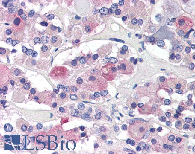 Anti-AVPR1B antibody IHC of human anterior pituitary. Immunohistochemistry of formalin-fixed, paraffin-embedded tissue after heat-induced antigen retrieval. Antibody LS-B2769 concentration 5 ug/ml.