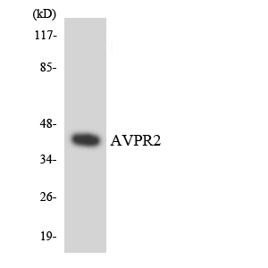 Western blot of the lysates from Jurkat cells using AVPR2 antibody.