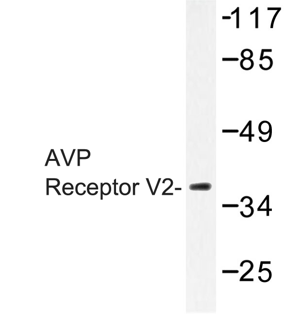 Western blot of AVP Receptor V2 (L111) pAb in extracts from RAW264.7 cells.