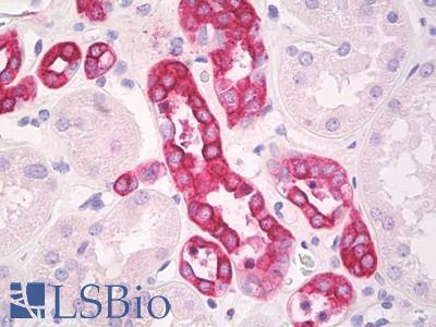 Anti-AVPR2 antibody IHC of human kidney. Immunohistochemistry of formalin-fixed, paraffin-embedded tissue after heat-induced antigen retrieval. Antibody LS-B8250 dilution 2.5-5 ug/ml.