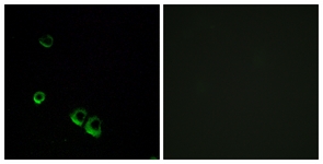 Immunofluorescence of MCF7 cells, using AVPR2 Antibody. The picture on the right is treated with the synthesized peptide.