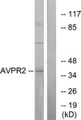Western blot of extracts from RAW264.7 cells, using AVPR2 Antibody. The lane on the right is treated with the synthesized peptide.