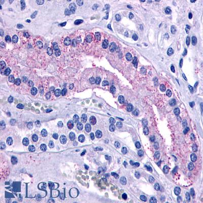 Anti-AVPR2 antibody LS-A272 IHC of human kidney, renal tubules. Immunohistochemistry of formalin-fixed, paraffin-embedded tissue after heat-induced antigen retrieval.