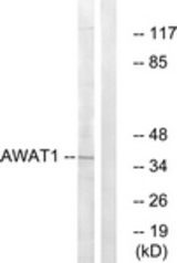 Western blot of extracts from 293 cells, using AWAT1 Antibody. The lane on the right was incubated with synthetic peptide.