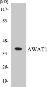 Western blot of the lysates from HT-29 cells using AWAT1 antibody.