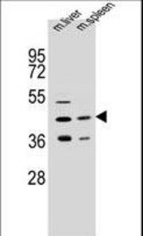 AWAT2 Antibody western blot of mouse liver,spleen tissue lysates (35 ug/lane). The AWAT2 antibody detected the AWAT2 protein (arrow).