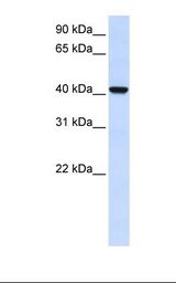 Fetal brain lysate. Antibody concentration: 1.0 ug/ml. Gel concentration: 12%.