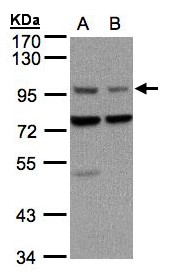 Sample (30 ug of whole cell lysate). A: A431, B: H1299. 7.5% SDS PAGE. AXIN antibody diluted at 1:1500