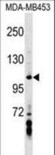 AXIN1 Antibody western blot of MDA-MB453 cell line lysates (35 ug/lane). The AXIN1 antibody detected the AXIN1 protein (arrow).