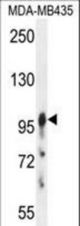 AXIN1 Antibody western blot of MDA-MB435 cell line lysates (35 ug/lane). The AXIN1 antibody detected the AXIN1 protein (arrow).