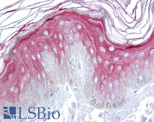 Anti-AXIN1 / AXIN antibody IHC of human skin. Immunohistochemistry of formalin-fixed, paraffin-embedded tissue after heat-induced antigen retrieval. Antibody LS-B6982 concentration 5 ug/ml.