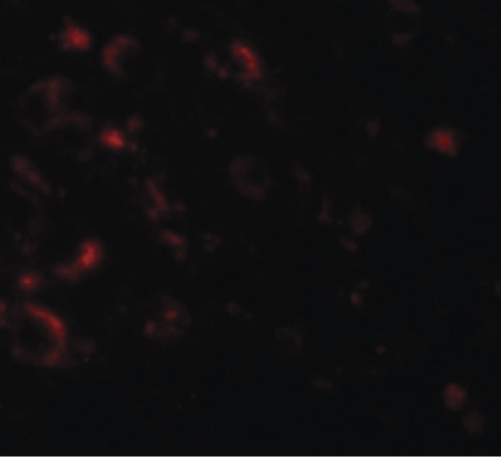 Immunofluorescence of AXIN1 in human brain tissue with AXIN1 antibody at 20 ug/ml.