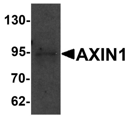 Western blot analysis of AXIN1 in SK-N-SH cell lysate with AXIN1 antibody at 1 ug/ml.