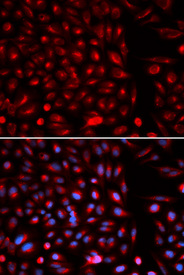 Immunofluorescence analysis of U2OS cell using AXIN2 antibody. Blue: DAPI for nuclear staining.