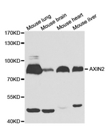 Western blot analysis of extracts of various cell lines, using AXIN2 antibody.