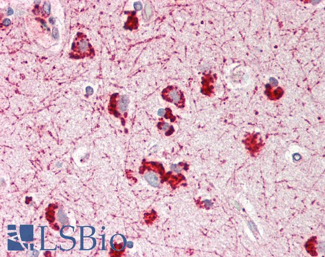 Human Brain, Cortex: Formalin-Fixed, Paraffin-Embedded (FFPE)