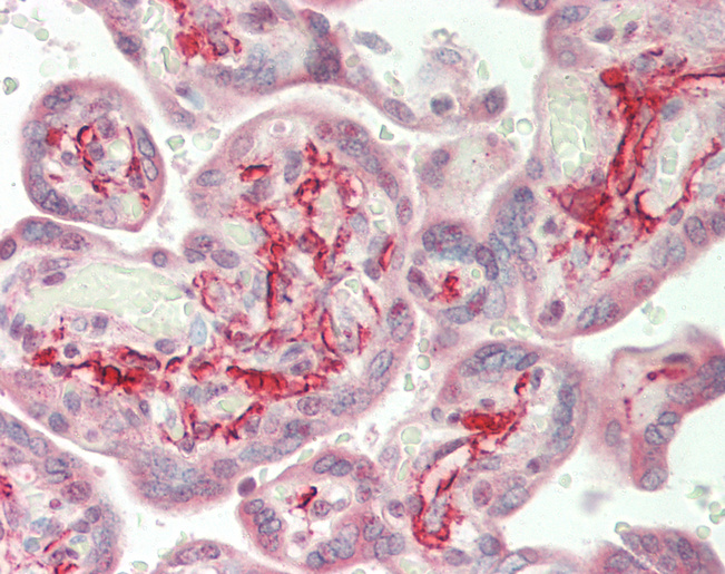 Human Placenta: Formalin-Fixed, Paraffin-Embedded (FFPE)