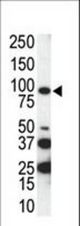 Western blot of anti-AXL C-term antibody in SKBR3 cell lysate. AXL (arrow) was detected using purified antibody. Secondary HRP-anti-rabbit was used for signal visualization with chemiluminescence.
