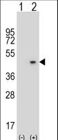 Western blot of AZGP1 (arrow) using rabbit polyclonal AZGP1 Antibody. 293 cell lysates (2 ug/lane) either nontransfected (Lane 1) or transiently transfected (Lane 2) with the AZGP1 gene.