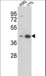 Western blot of AZGP1 Antibody in K562, Y79 cell line lysates (35 ug/lane). AZGP1 (arrow) was detected using the purified antibody.