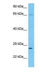 Western blot of AZI2 Antibody with human 786-0 Whole Cell lysate.