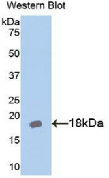 Western blot of recombinant AcPL / IL18RAP.