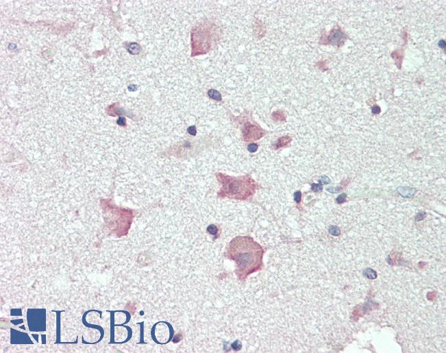 Anti-Acetyl-CoA Carboxylase / ACC antibody IHC staining of human brain, cortex. Immunohistochemistry of formalin-fixed, paraffin-embedded tissue after heat-induced antigen retrieval.
