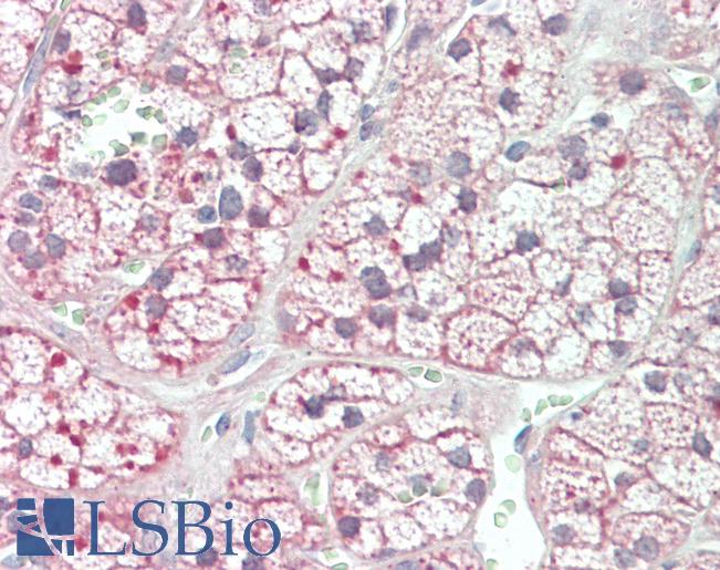 Anti-Acetyl-CoA Carboxylase / ACC antibody IHC staining of human adrenal. Immunohistochemistry of formalin-fixed, paraffin-embedded tissue after heat-induced antigen retrieval. Antibody LS-B11308 concentration 5 ug/ml.