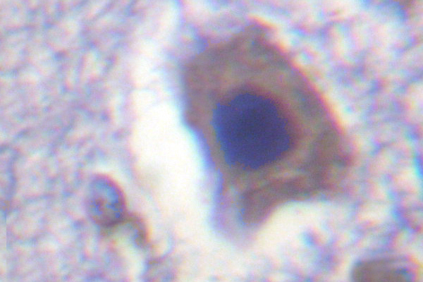 IHC of ACC1 (H74) pAb in paraffin-embedded human skeletal muscle brain tissue.