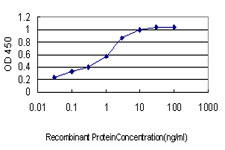 Detection limit for recombinant GST tagged ACACA is approximately 0.03 ng/ml as a capture antibody.