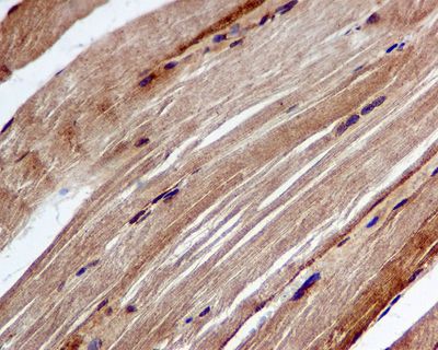 IHC of paraffin-embedded skeletal muscle tissue using anti-Acetyl CoA Carboxylase 1 (ACC1) antibody.