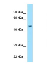 ACR / Acrosin antibody LS-C145372 Western blot of Fetal Lung lysate. Antibody concentration 1 ug/ml.