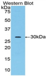 Western blot of recombinant Acrosin.