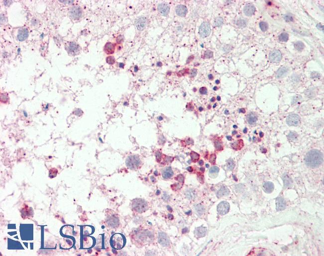 Anti-Acrosin antibody IHC staining of human testis. Immunohistochemistry of formalin-fixed, paraffin-embedded tissue after heat-induced antigen retrieval.