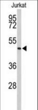 Western blot of ACR Antibody in Jurkat cell line lysates (35 ug/lane). ACR (arrow) was detected using the purified antibody.