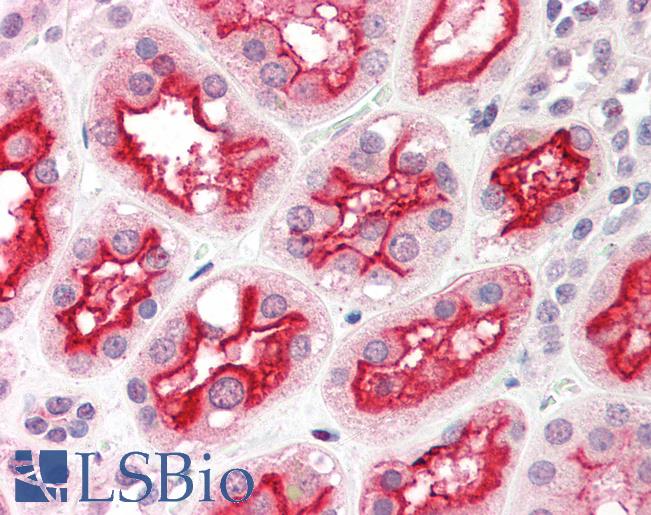 Anti-ACE-2 antibody IHC of human kidney. Immunohistochemistry of formalin-fixed, paraffin-embedded tissue after heat-induced antigen retrieval. Antibody LS-B439 concentration 5 ug/ml.