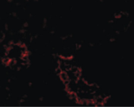 Immunofluorescence of ACE2 in Human Kidney cells with ACE2 antibody at 20 ug/ml.