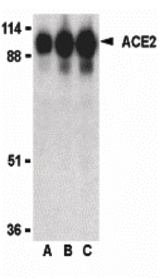 Western blot of ACE2 in human kidney lysate with ACE2 antibody at (A) 0.5, (B) 1 and (C) 2 ug/ml.