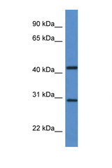ACER1 / ASAH3 antibody LS-C135889 Western blot of Fetal Brain lysate. Antibody concentration 1 ug/ml.