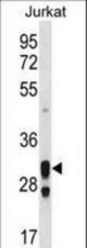 ACER1 Antibody western blot of Jurkat cell line lysates (35 ug/lane). The ACER1 antibody detected the ACER1 protein (arrow).