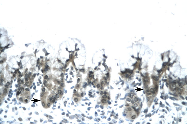 ADIPOQ / Adiponectin antibody LS-C30652 IHC of formalin-fixed, paraffin-embedded human Stomach. Positive label: Epithelial cells of fundic gland indicated with arrows. Antibody concentration 4-8 ug/ml. Magnification 400X.