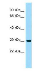 ACER2 antibody Western Blot of Fetal Lung.