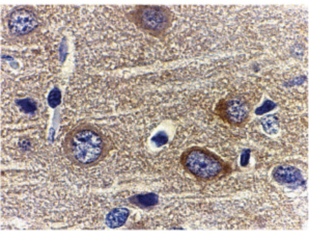 Immunohistochemistry of adiponectin in rat brain tissue with adiponectin antibody at 1 ug/ml.