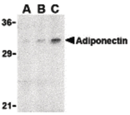 Western blot of adiponectin in rat brain cell lysate with adiponectin antibody at (A) 1, (B) 2, and (C) 4 ug/ml.