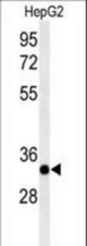 Western blot of ACER3 Antibody in HepG2 cell line lysates (35 ug/lane). ACER3 (arrow) was detected using the purified antibody.